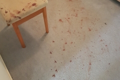 Blood Stain Removal_1